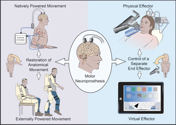 Neuroprosthetics